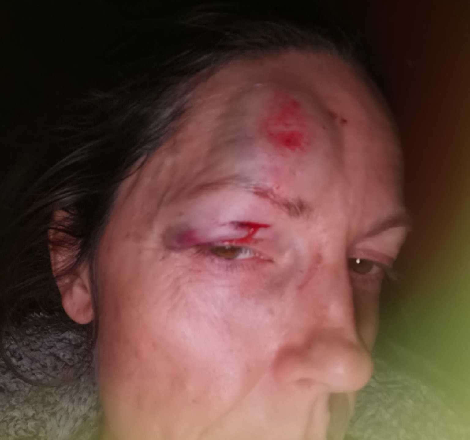 Mum suffers facial injuries after falling on fly-tipped rubbish in Cliftonville Avenue, Margate