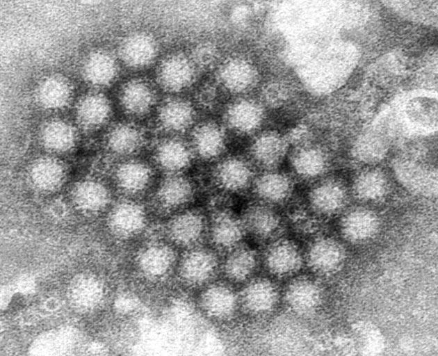 Nasty Norovirus Is Back In Full Force With U.S. Cases Spiking