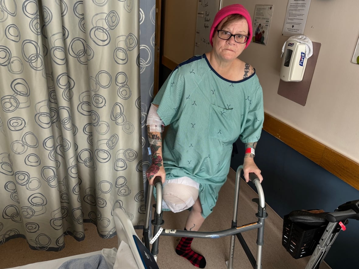 Woman's right leg amputated after waiting 8 days for bed at Winnipeg's HSC to treat open wound