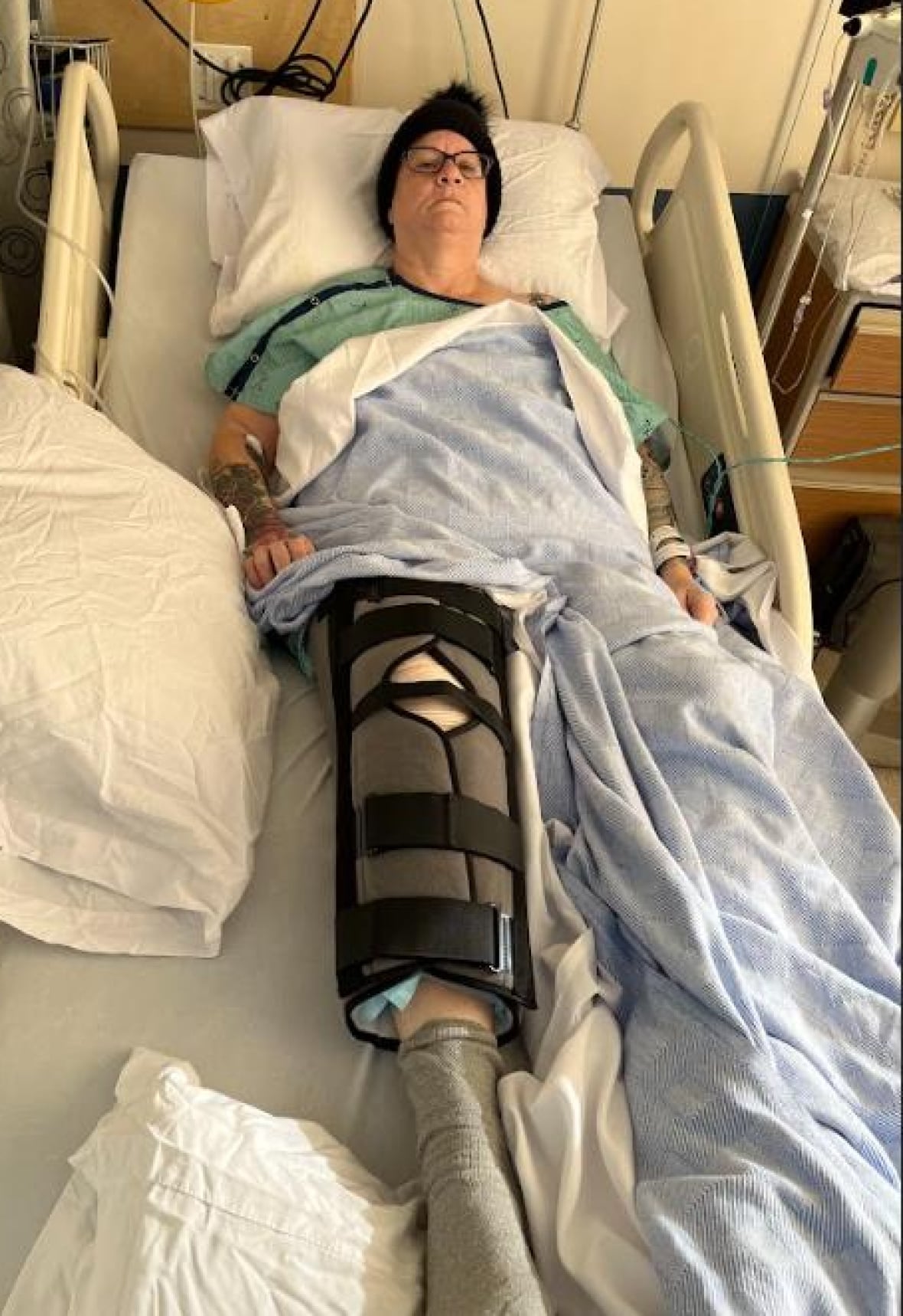 Manitoba woman set to lose right leg after languishing in hospital bed with open wound