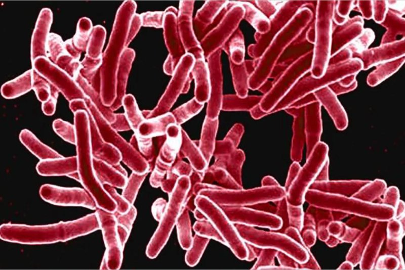 2 dead, at least 146 infected as Kansas battles spreading tuberculosis outbreak