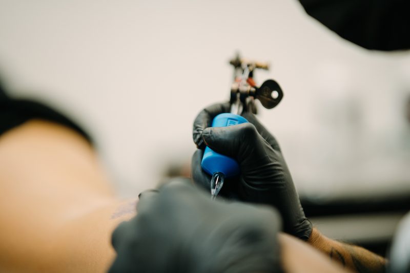 Need to get a tattoo removed? What to know about the risks, the cost and more