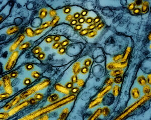 First U.S. bird flu death is announced in Louisiana