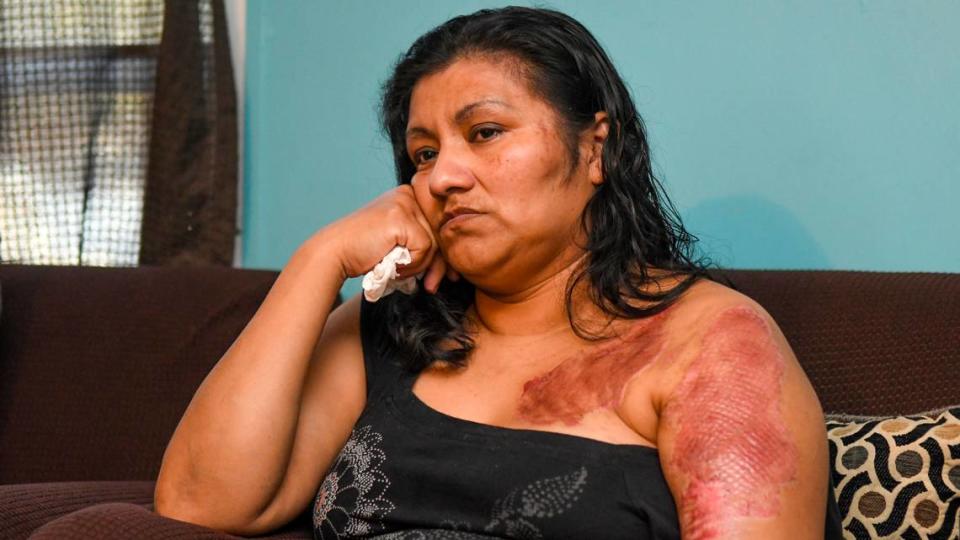 Doused with acid and robbed at knifepoint, this Hilton Head mother of 6 now lives in fear