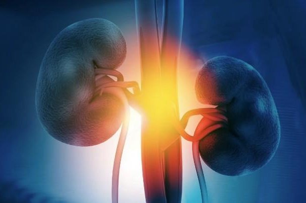 Experimental vaccine seems to battle advanced kidney cancers